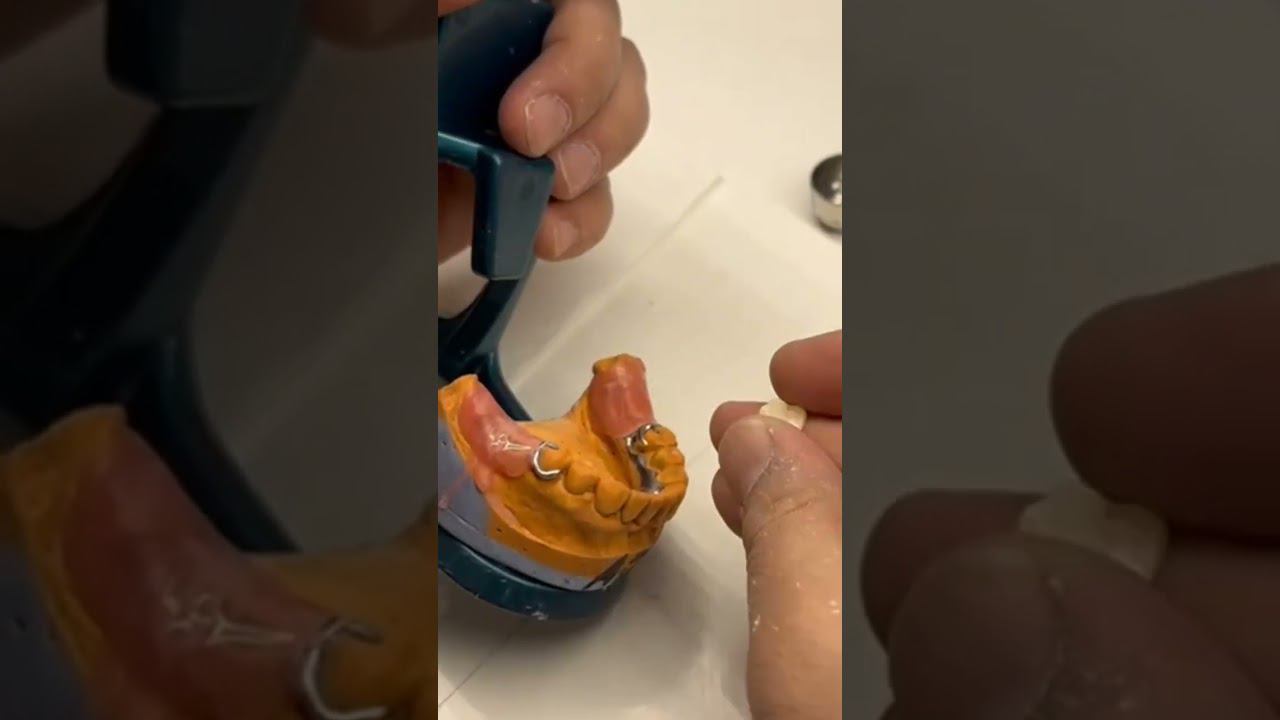 Примерка зубных коронок на модели в зуботехнической лаборатории "Эстетикс" #эстетикс смотреть онлайн