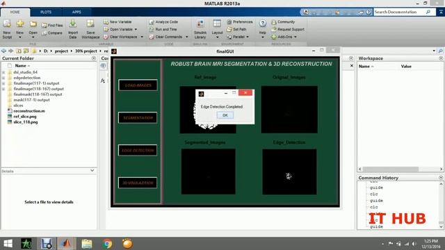 MRI image Processing & Segmentation 3d Reconstruction by using Matlab. смотреть онлайн