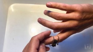 Укусил мизгирь (тарантул южнорусский)