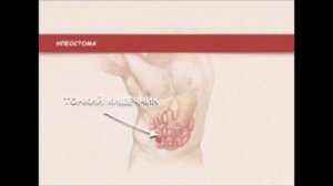 1  Введение  Типы стом