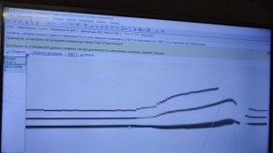 Hyundai Santa FE  Потеря мощности