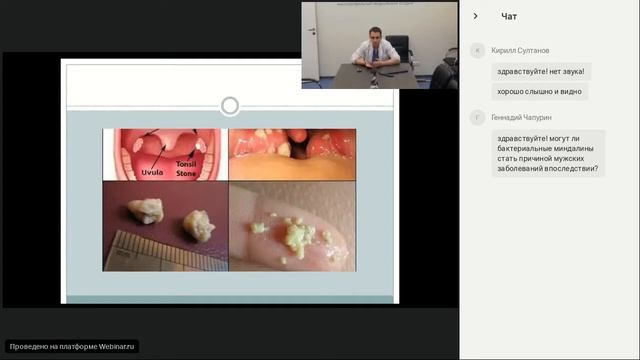 Запись вебинара «Болезни миндалин у детей» - Лаберко Е.Л. (13.06.2018) смотреть онлайн