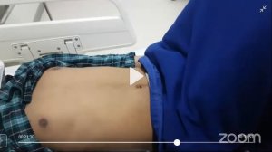 Abdominal Examination Demonstration