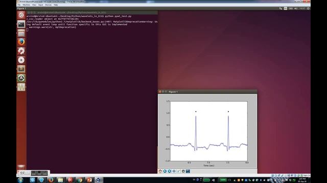 Python Continuous Wavelet applied to ECG смотреть онлайн