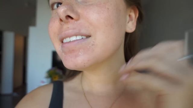 My VI Peel Experience + What To Expect смотреть онлайн