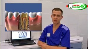 ПУЛЬПИТ ЗУБА  ЧТО ЭТО ТАКОЕ И КАК ЕГО ЛЕЧИТЬ