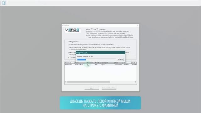 Как посмотреть запись исследования МРТ на диске смотреть онлайн
