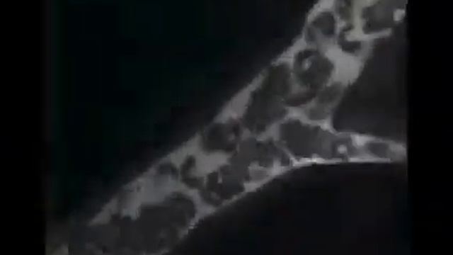 Time Lapse Adipose Tissue in Vivo by Dr Satoshi Nishimura смотреть онлайн