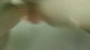 Принципиально новый бюгельный протез