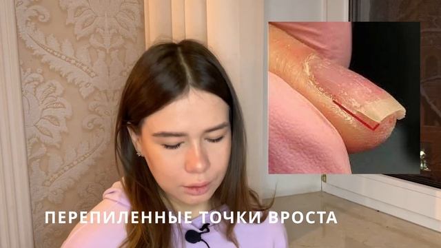 ОТСЛОЙКИ | Причины и мои рекомендации