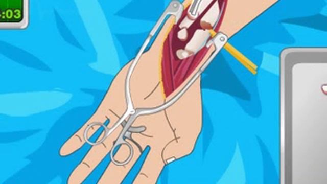 Arm Surgery Gameplay Игра На Русском Языке смотреть онлайн