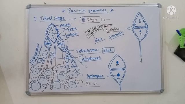 PUCCINIA GRAMINIS (PART-3) || TELIOSPORE & BASIDIOSPORE || FUNGI || RUST OF WHEAT смотреть онлайн
