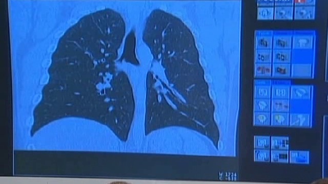 Kashel-prichini-kashla