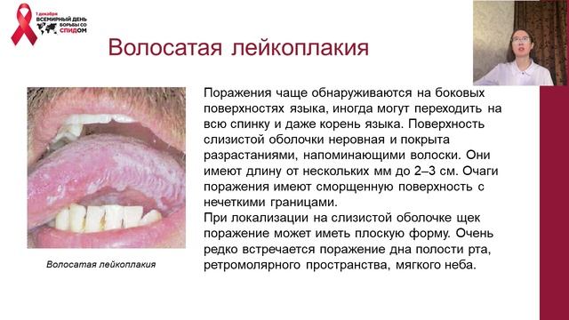 11. Бикмуллина Дина Рустамовна. 4 курс, 2 группа, стоматологический факультет смотреть онлайн