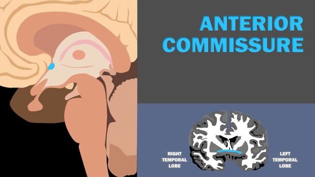 WHITE MATTER TRACTS OF THE BRAIN (1/3) - COMMISSURAL TRACTS смотреть онлайн