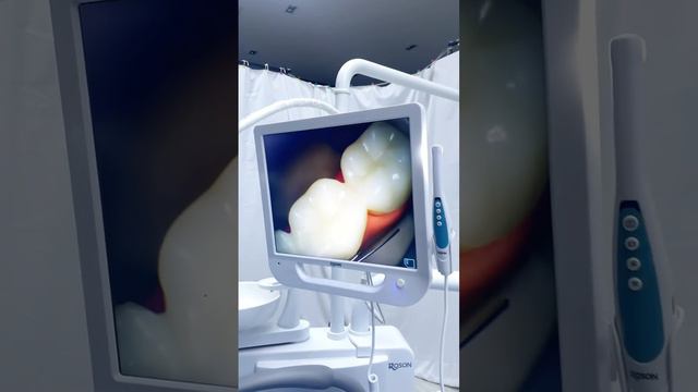 ROSON KLT-6210 N1#dental #dentist #dentalcare #dentalclinic смотреть онлайн