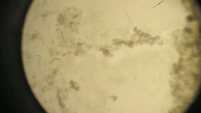 Day 1 elegans CL4176 H11 after UV 7:11:2014 DSC 0066 смотреть онлайн