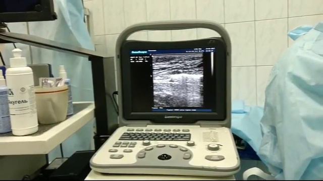 ЭВЛО Vein Act Prolong смотреть онлайн