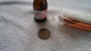 Гигрома запястья и мой опыт лечения.