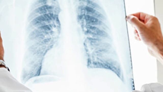 Барьерная функция легких - Lung barrier function смотреть онлайн