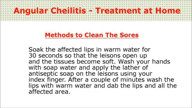 How to Get Rid of Angular Cheilitis Fast & Easy - Fast Method To Get Rid of Angular Cheilitis смотреть онлайн
