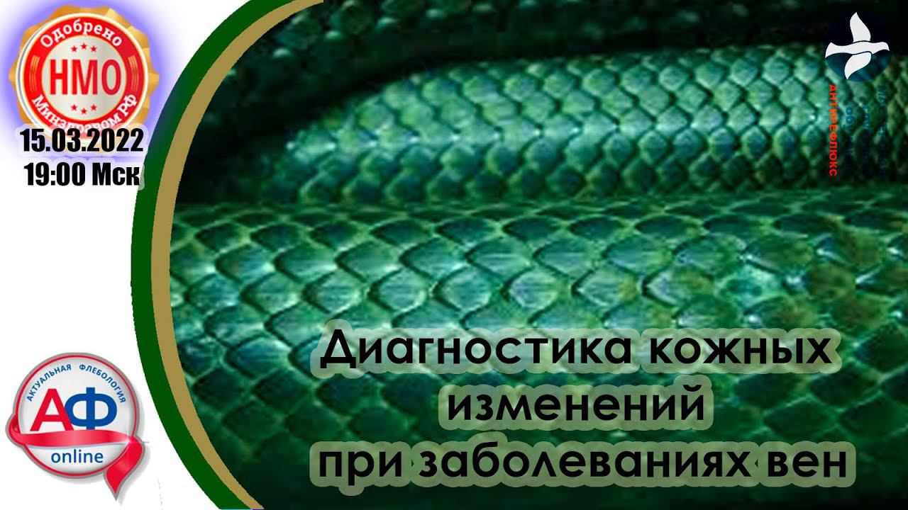 Диагностика кожных изменений при заболеваниях вен смотреть онлайн
