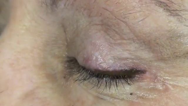 Permanent Makeup Eyeliner Slope® Technique Linda Dixon MD смотреть онлайн
