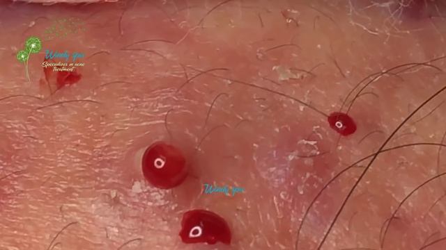 Make Your Day Relaxing with Windy Spa 6#175 смотреть онлайн