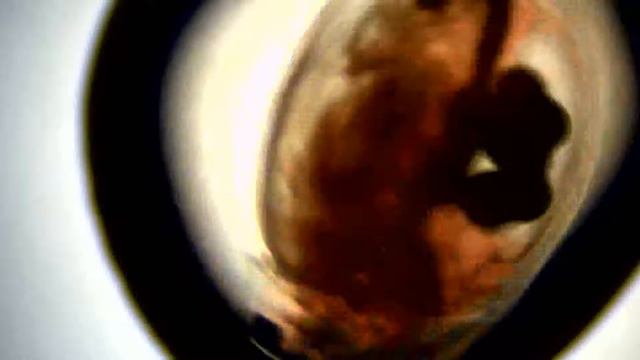 Aspirin 0 001 mg per mL 1 смотреть онлайн