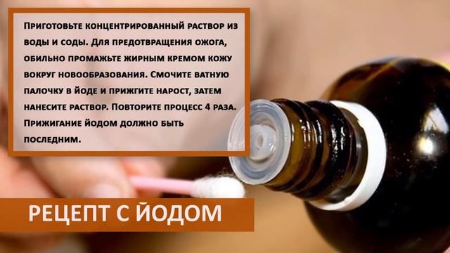 Если НАДО БЫСТРО избавиться от ПАПИЛЛОМ смотреть онлайн