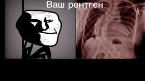 Ваш рентген, жуткие лица мистера исключительного