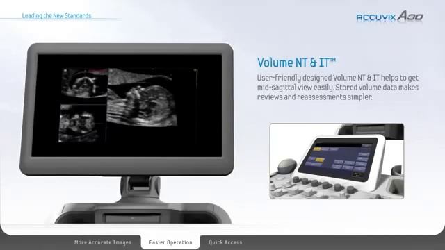 УЗИ Medison Accuvix A30