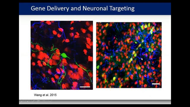 Webinar: Elisa Konofagou, PhD - Focused Ultrasound for Parkinson’s Disease in Preclinical Models смотреть онлайн