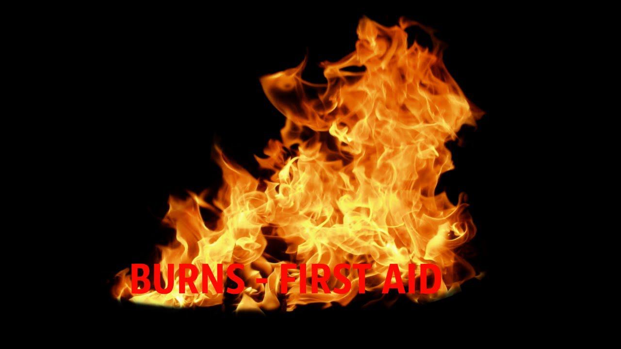 First Aid - Burns