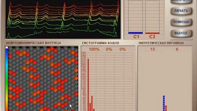 Результаты применения ионизатора 'Сферион', часть 1 смотреть онлайн