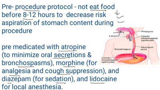 Bronchoscopy in hindi | bronchoscopy | bronchoscopy procedure | ब्रोंकोस्कोपी जांच | Nursing office смотреть онлайн