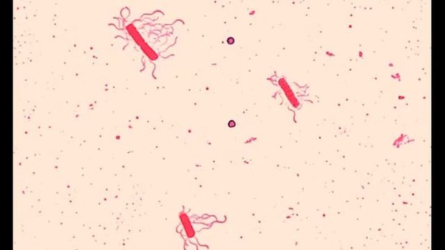 Бациллы смотреть онлайн