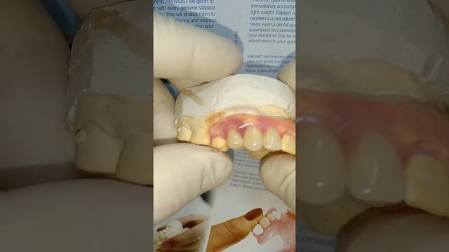 Нейлоновый протез смотреть онлайн