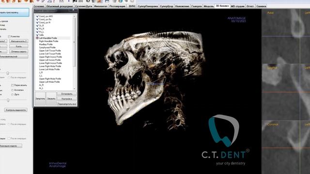 InVivo 3d ceph смотреть онлайн