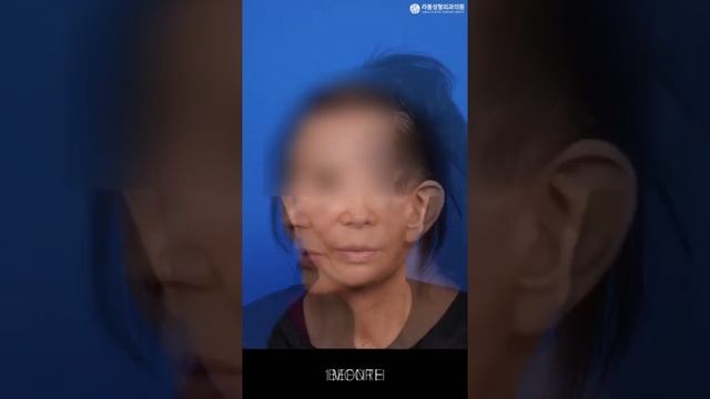 어느새 늘어버린 주름이 걱정되신다면! 안면목거상으로 시간되돌리기!? смотреть онлайн