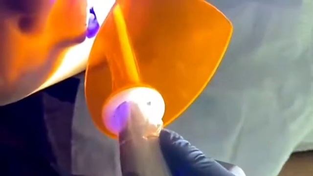 Baolai CL-B wide spectrum dental led curing light caries detection function смотреть онлайн