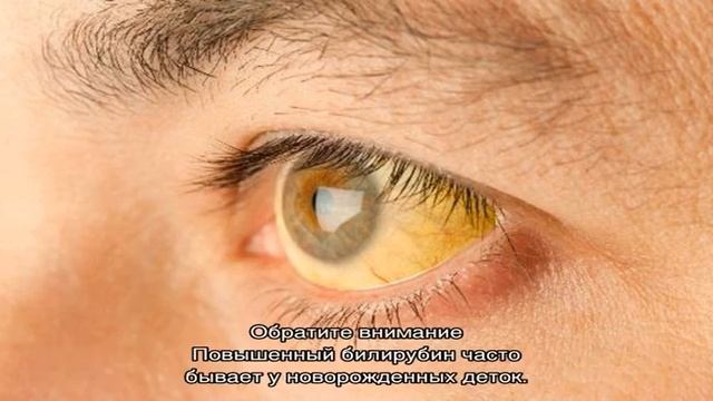 Как лечить повышенный билирубин смотреть онлайн