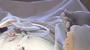 Пункция и катетеризация подключичной вены