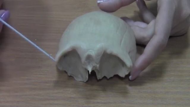 Лобная кость смотреть онлайн