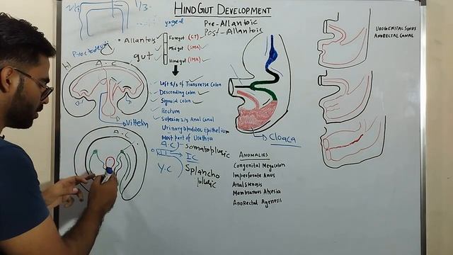 DEVELOPMENT OF HINDGUT - GIT EMBRYOLOGY 9 смотреть онлайн
