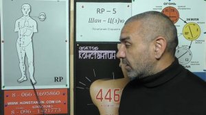 Растяжение связок стопы.