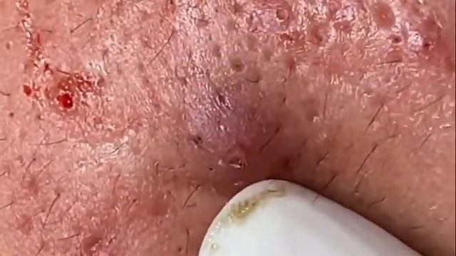 Чёрные точки