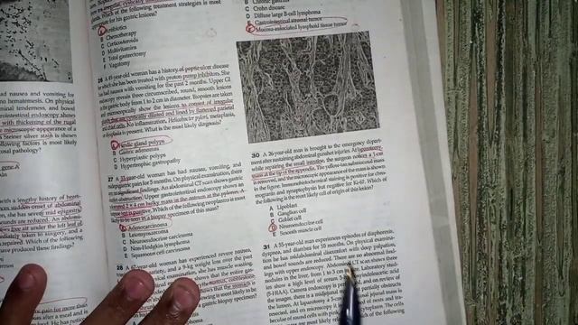 robbin mcqs revision of git pathology смотреть онлайн