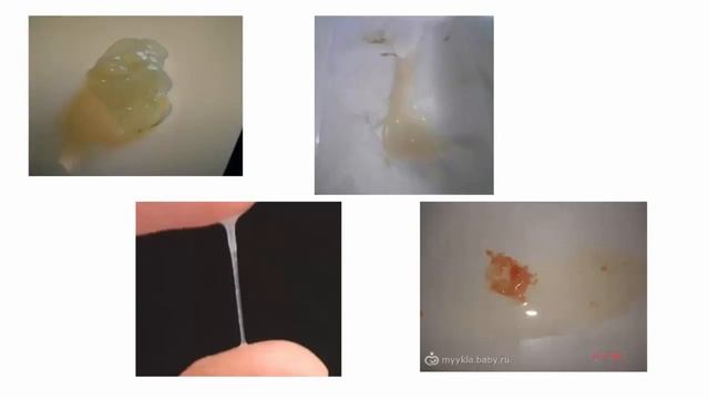 Как отходит пробка How does the tube смотреть онлайн