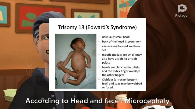 Trisomy 18 ( Edwards syndrome ) смотреть онлайн